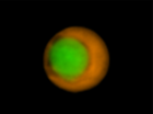 This picture shows that the green cell is inside the red cell.